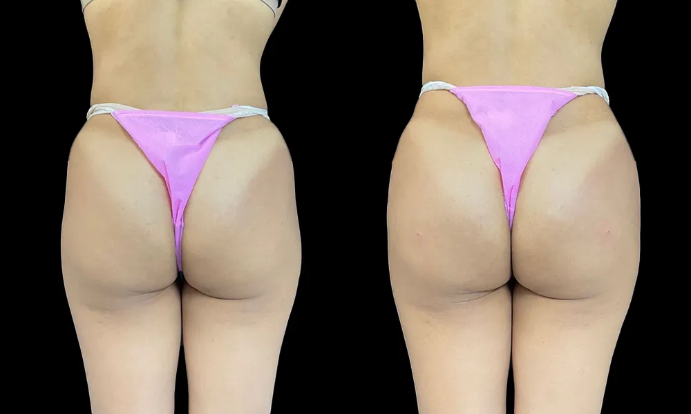 _hips dips_11zon